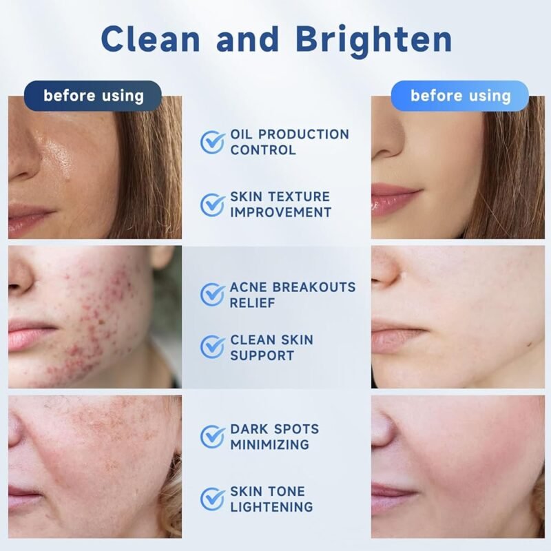 RAGKUN Almohadillas Exfoliantes con Ácido Glicólico 20% y Vitaminas - Imagen 6