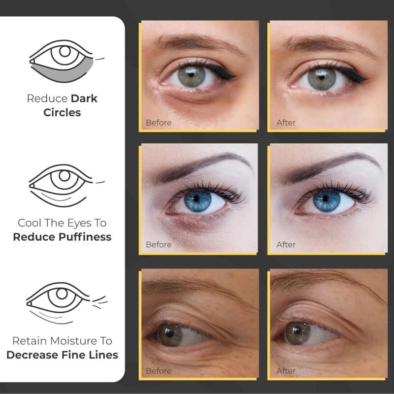 Parches para debajo de los ojos con colágeno y cafeína para ojeras - Imagen 3