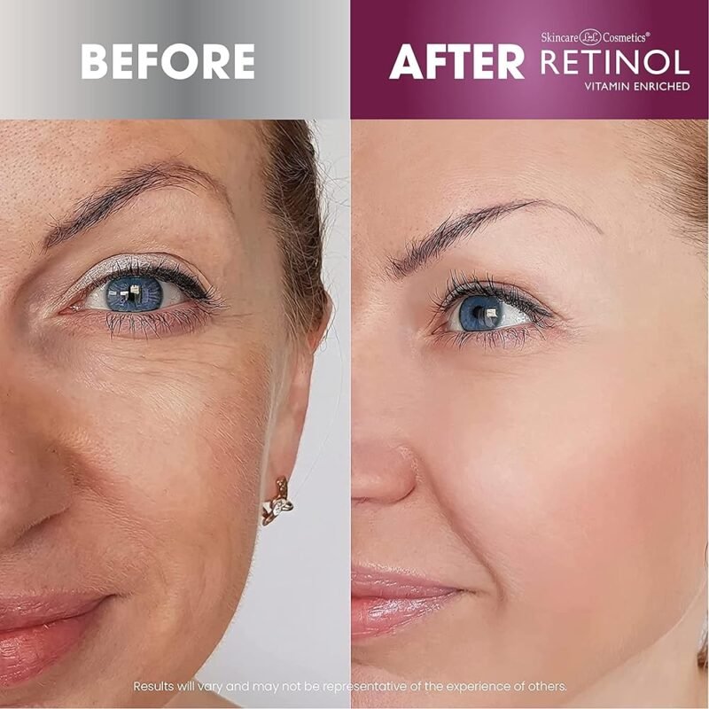 Retinol Toallitas Limpiadoras Antienvejecimiento Todo en Uno - Imagen 5